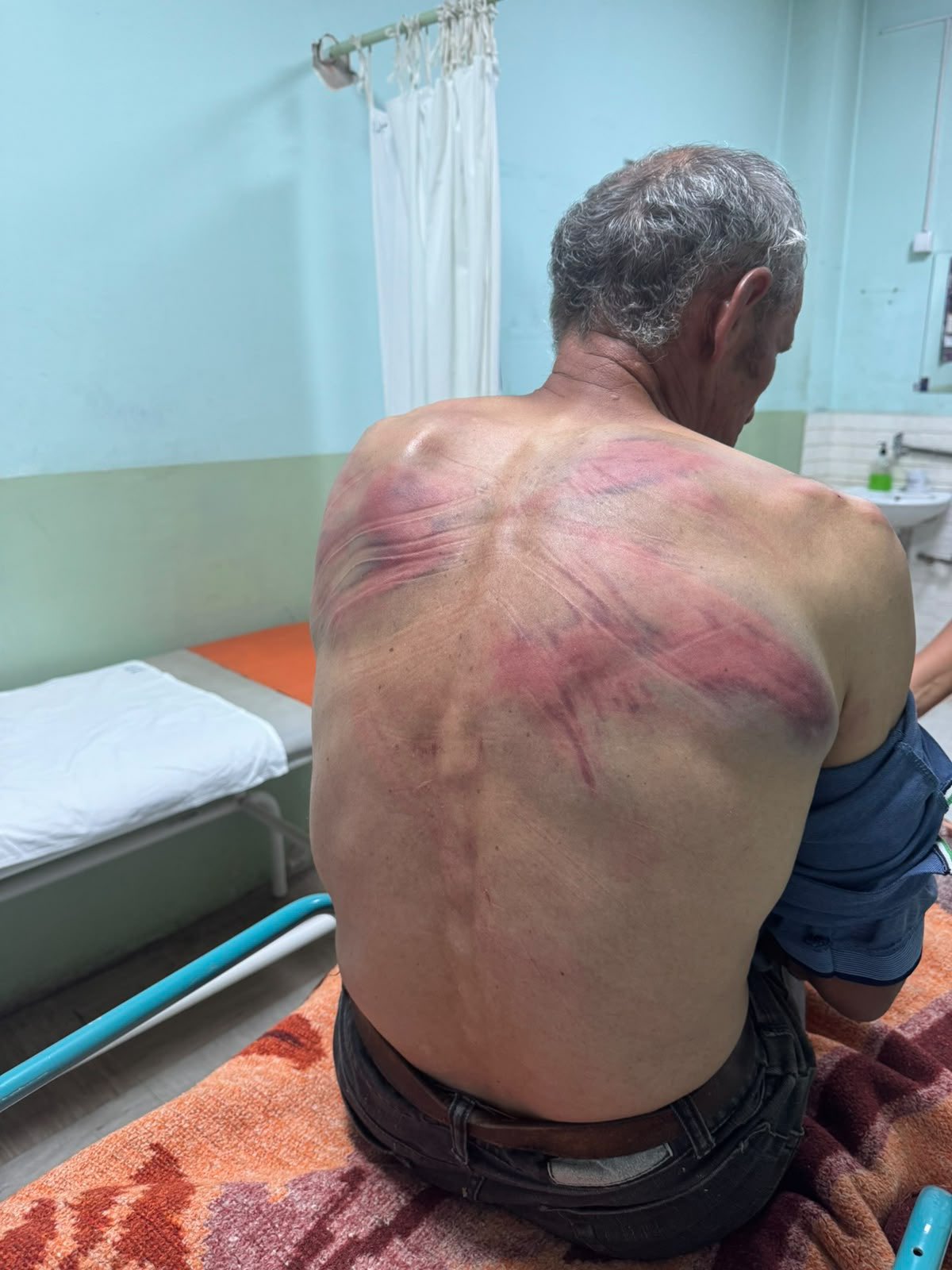 Prijavljeno brutalno prebijanje na Kosovu: Rašković tvrdi da su ga policajci vezali za drvo